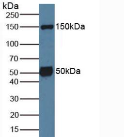 Western Blot; Sample: Recombinant SGK1, Mouse.