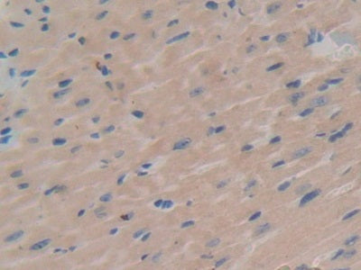 DAB staining on IHC-P; Samples: Mouse Kidney Tissue