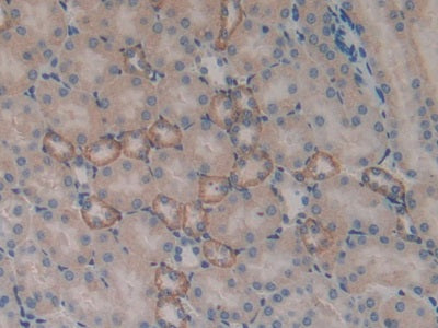 Serum/Glucocorticoid Regulated Kinase 1 (SGK1) Polyclonal Antibody - image 5