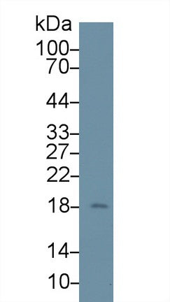 Figure. Western Blot; Sample: Recombinant LCN1, Rat.