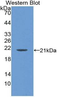 Lipocalin 1 (LCN1) Polyclonal Antibody - image 3