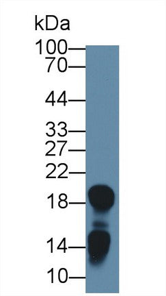 Western Blot; Sample: Human Urine; Primary Ab: 1µg/ml Rabbit Anti-Human LCN1 Antibody Second Ab: 0.2µg/mL HRP-Linked Caprine Anti-Rabbit IgG Polyclonal Antibody