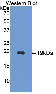 Interleukin 17B (IL17B) Polyclonal Antibody - image 2