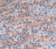 Interleukin 17B (IL17B) Polyclonal Antibody - image 3