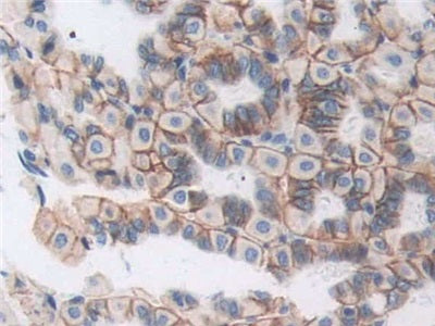 DAB staining on IHC-P; Samples: Mouse Brain Tissue