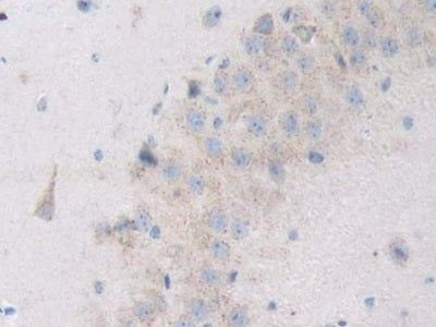 Angiopoietin Like Protein 3 (ANGPTL3) Polyclonal Antibody - image 5