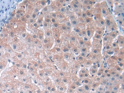 DABstainingonIHC-P.Samples:HumanTissue)