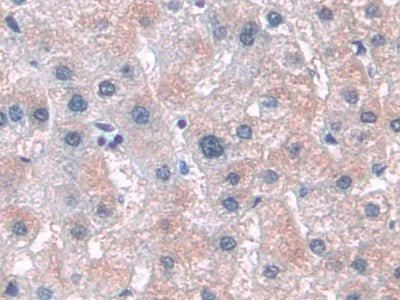 Angiopoietin Like Protein 3 (ANGPTL3) Polyclonal Antibody - image 4