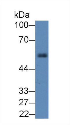 Western Blot; Sample: Recombinant protein.