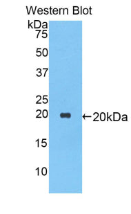 Alpha-1-Antitrypsin (a1AT) Polyclonal Antibody - image 3