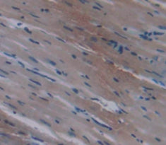 Alpha-1-Antitrypsin (a1AT) Polyclonal Antibody - image 4