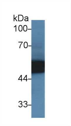 Western Blot; Sample: Recombinant protein.