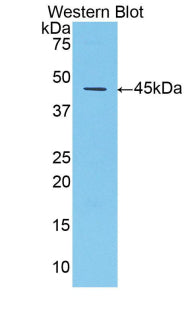 DAB staining on IHC-P; Samples: Mouse Liver Tissue;  Primary Ab: 20µg/ml Rabbit Anti-Mouse a1AT Anti