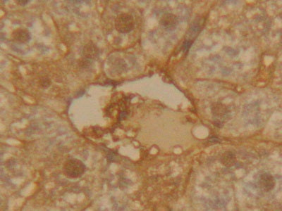 Alpha-1-Antitrypsin (a1AT) Polyclonal Antibody - image 5