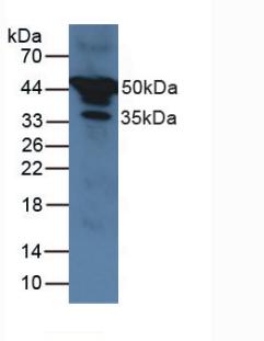 Western Blot; Sample: Recombinant a1AT, Human.
