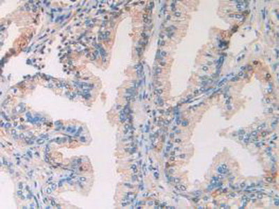 DAB staining on IHC-P; Samples: Human Pancreas Tissue.