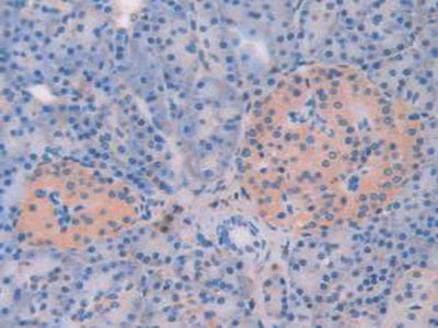 Alpha-1-Antitrypsin (a1AT) Polyclonal Antibody - image 5