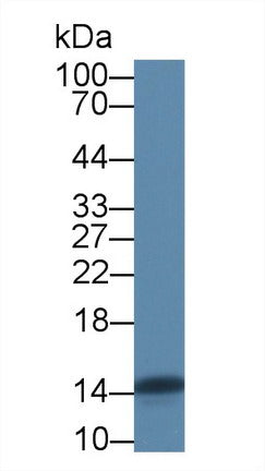 Fatty Acid Binding Protein 4 (FABP4) Polyclonal Antibody - image 3