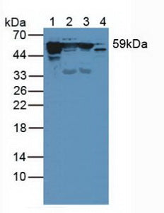 Western Blot; Sample: Human A431 cell lysate; ; Primary Ab: 3µg/ml Rabbit Anti-Human KRT10 Antibody; Second Ab: 0.2µg/mL HRP-Linked Caprine Anti-Rabbit IgG Polyclonal Antibody;