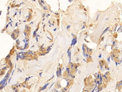 DAB staining on IHC-P. Samples: Human Tissue)