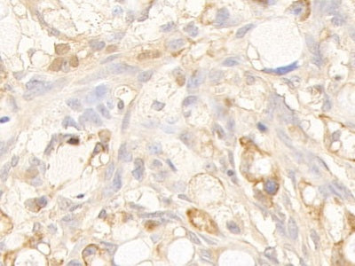 Cytokeratin 10 (CK10) Polyclonal Antibody - image 5