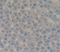 Integrin Alpha M (CD11b) Polyclonal Antibody - image 3