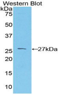 Used in DAB staining on fromalin fixed paraffin-embedded Kidney tissue