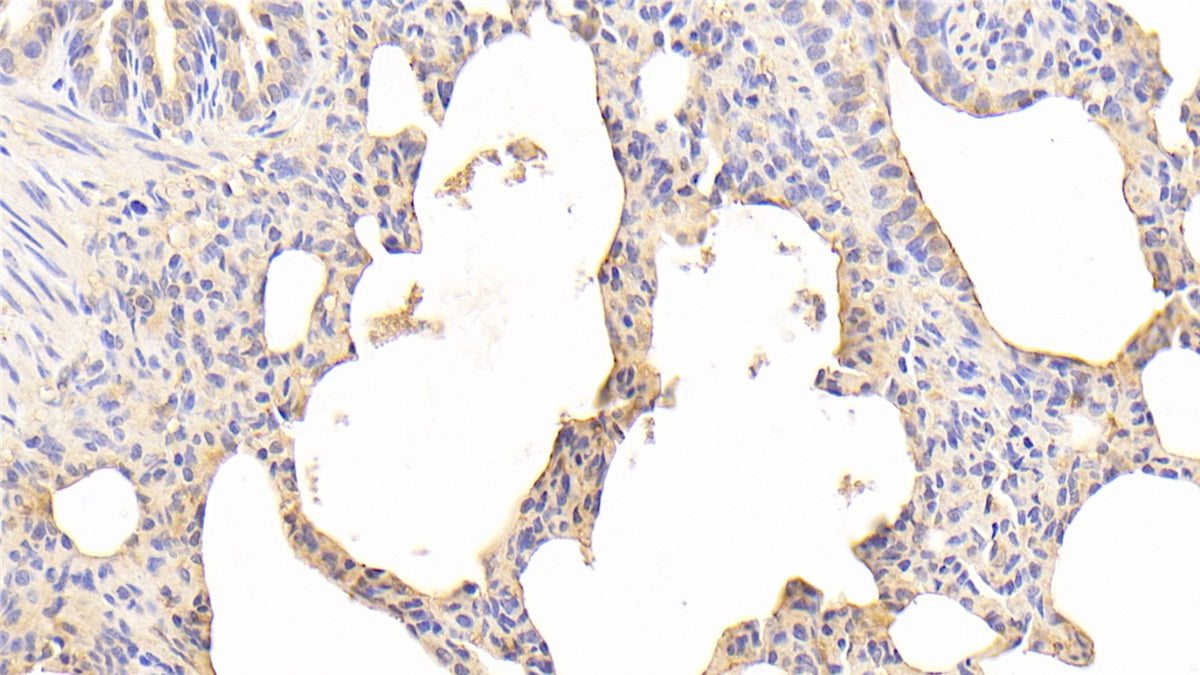 DABstainingonIHC-P.Samples:HumanTissue)