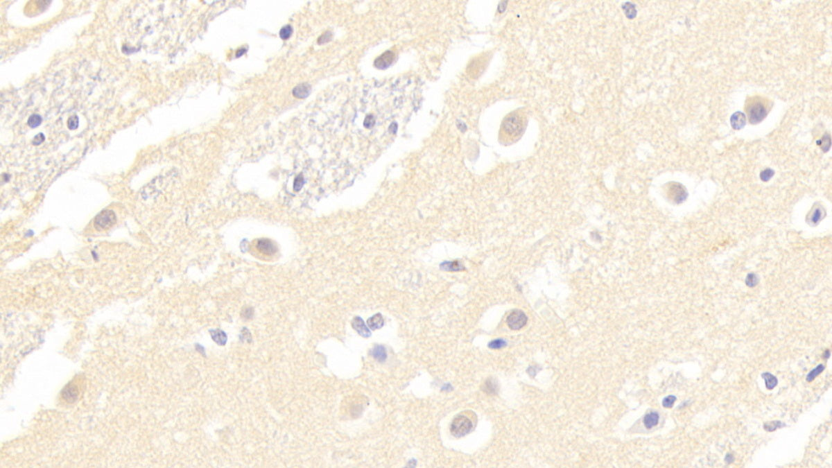 Melanotransferrin (MFI2) Polyclonal Antibody - image 4