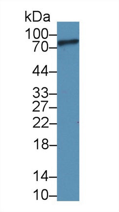 Western Blot; Sample: Recombinant protein.