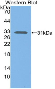DAB staining on IHC-P; Samples: Human Liver Tissue; Primary Ab: 20μg/ml Rabbit Anti-Human C1s Antibody Second Ab: 2µg/mL HRP-Linked Caprine Anti-Rabbit IgG Polyclonal Antibody