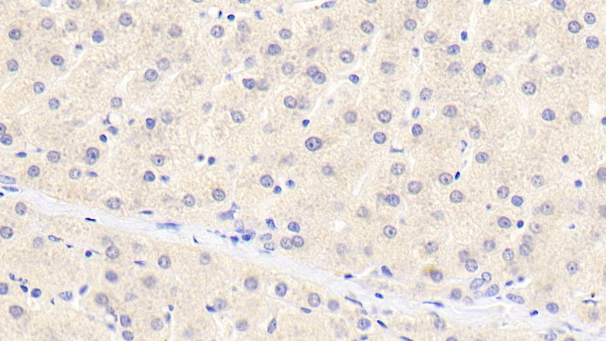 DAB staining on IHC-P. Samples: Human Tissue)