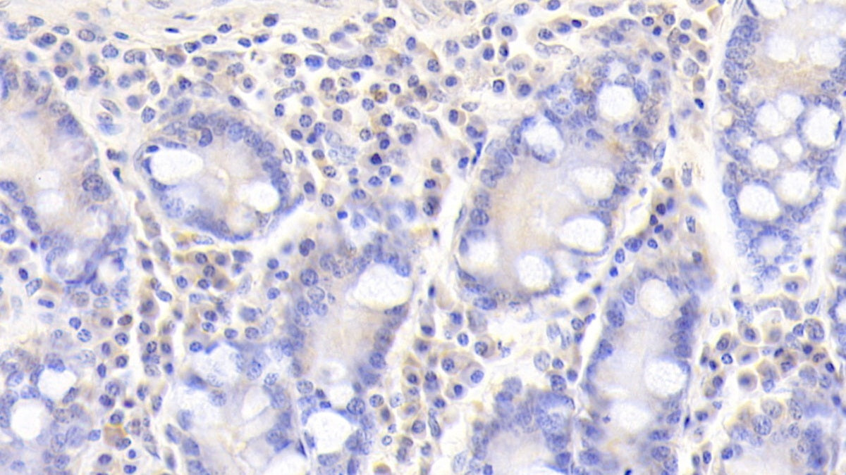 Complement Component 1, S Subcomponent (C1s) Polyclonal Antibody - image 5