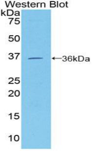 Cluster Of Differentiation 146 (CD146) Polyclonal Antibody - image 2
