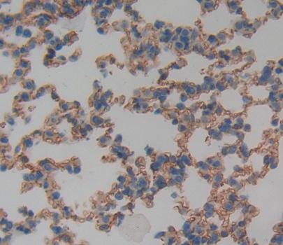 Cluster Of Differentiation 146 (CD146) Polyclonal Antibody - image 3