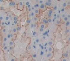 Cluster Of Differentiation 146 (CD146) Polyclonal Antibody - image 4