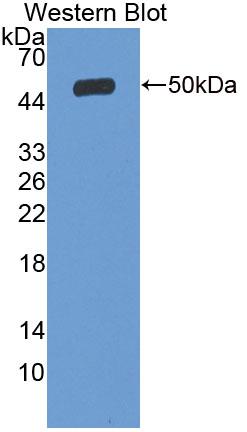 Solute Carrier Family 27 Member 5 (SLC27A5) Polyclonal Antibody - image 3