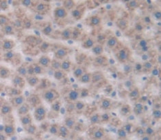 Solute Carrier Family 27 Member 5 (SLC27A5) Polyclonal Antibody - image 4