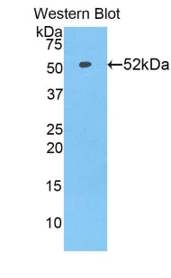 Solute Carrier Family 27 Member 5 (SLC27A5) Polyclonal Antibody - image 2