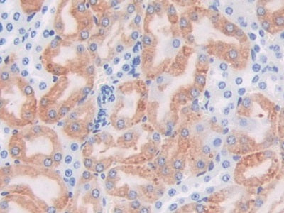 DAB staining on IHC-P; Samples: Mouse Kidney Tissue)
