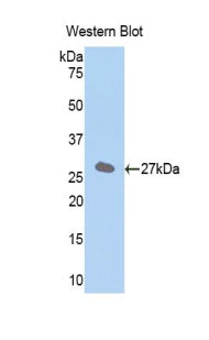 Western Blot; Sample: Mouse Liver lysate; ; Primary Ab: 1µg/ml Rabbit Anti-Mouse FATP5 Antibody; Second Ab: 0.2µg/mL HRP-Linked Caprine Anti-Rabbit IgG Polyclonal Antibody;