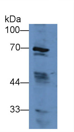 Solute Carrier Family 27 Member 5 (SLC27A5) Polyclonal Antibody - image 3