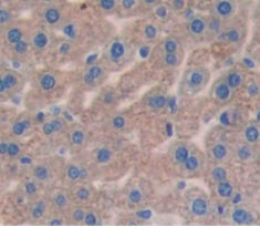 Solute Carrier Family 27 Member 5 (SLC27A5) Polyclonal Antibody - image 4