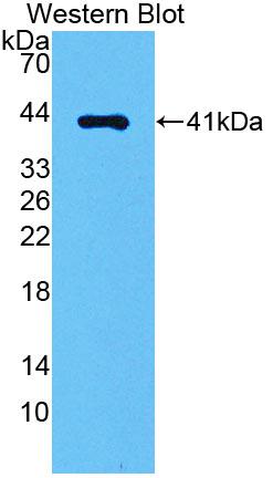 Angiotensin II Receptor 1 (AGTR1) Polyclonal Antibody - image 2