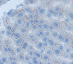 Angiotensin II Receptor 1 (AGTR1) Polyclonal Antibody - image 3