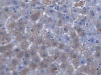 DAB staining on fromalin fixed paraffin- embedded liver tissue)