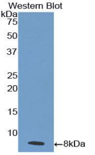 Western Blot; Sample: Lane1: Mouse Cerebrum lysate; Lane2: A549 cell lysate; Lane3: PANC1 cell lysate; Primary Ab: 3μg/ml Rabbit Anti-Human IL18R1 Antibody; Second Ab: 0.2µg/mL HRP-Linked Caprine Anti-Rabbit IgG Polyclonal Antibody;