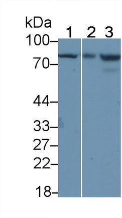 DAB staining on IHC-P; Samples: Human Stomach Tissue; Primary Ab: 20μg/ml Rabbit Anti-Human IL18R1 Antibody Second Ab: 2µg/mL HRP-Linked Caprine Anti-Rabbit IgG Polyclonal Antibody