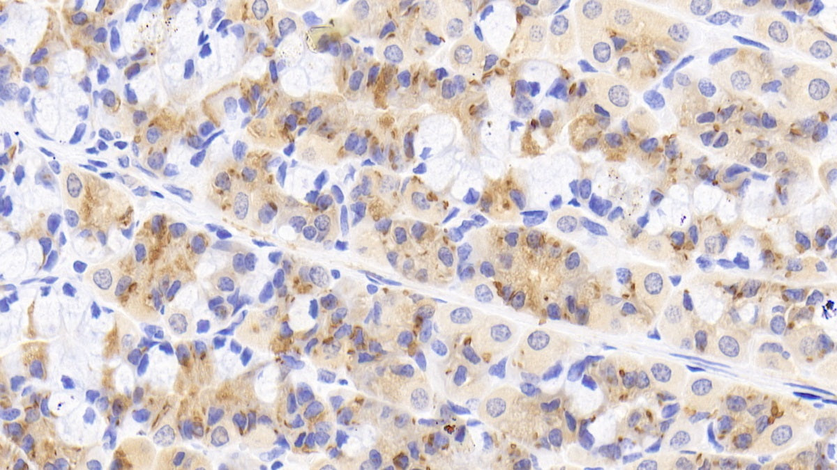 DABstainingonIHC-P.Samples:HumanTissue)