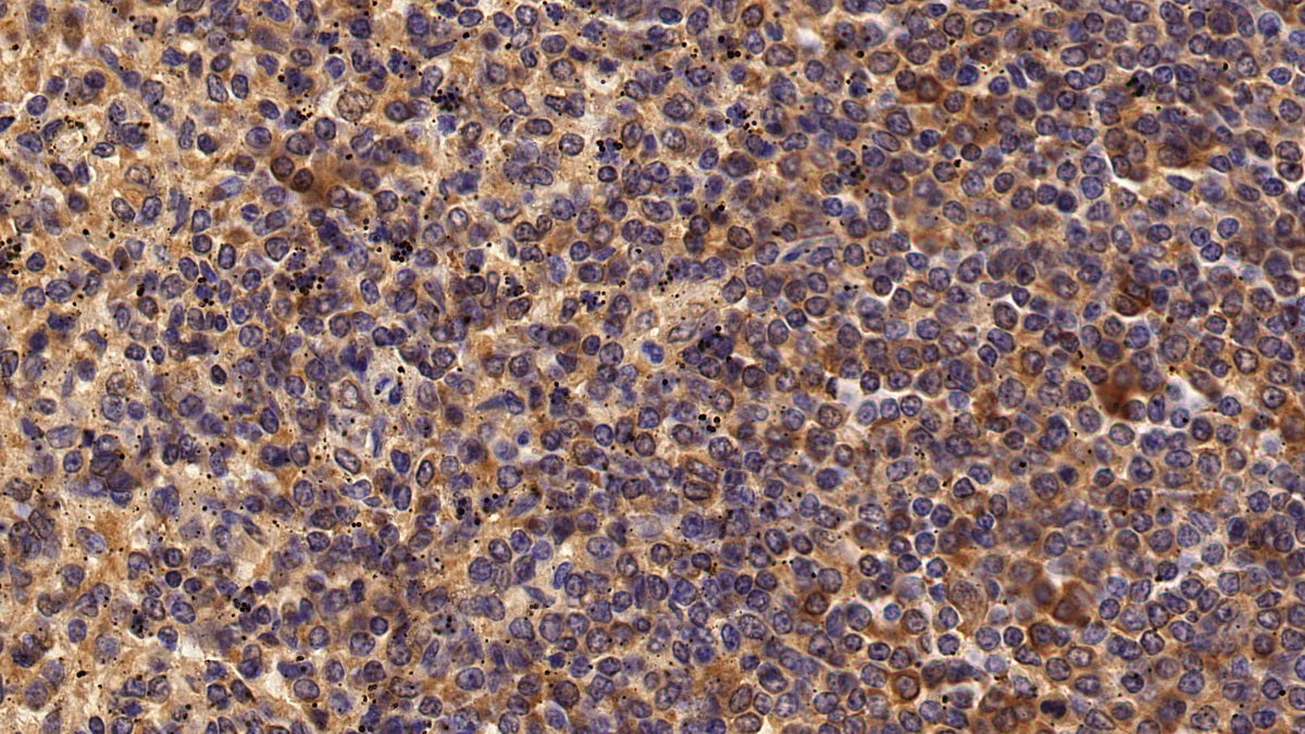 Interleukin 18 Receptor 1 (IL18R1) Polyclonal Antibody - image 5